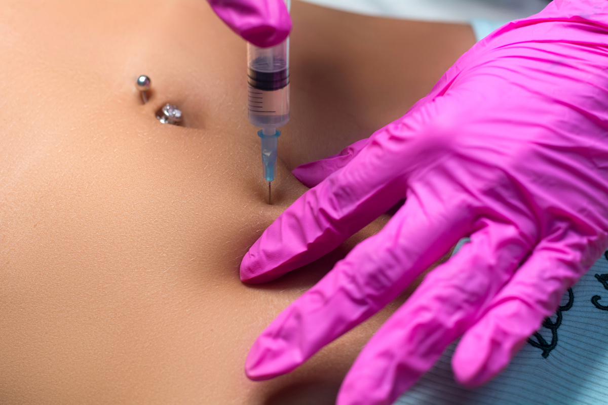 Lipolytic Injections to Burn Fat on the Stomach